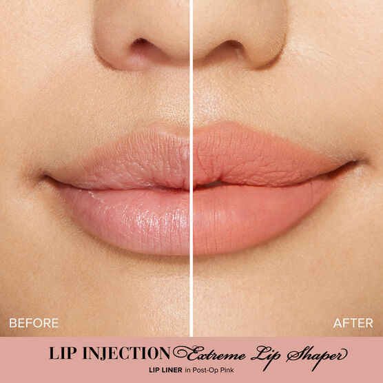Lip Injection L�pis de Boca Post Op Pink